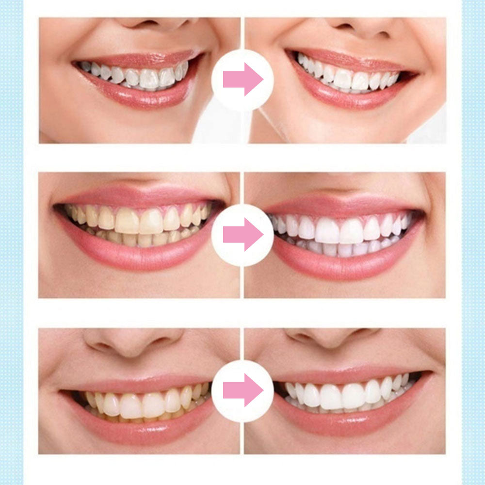 Teeth Whitening Pen Tooth Gel Whitener Bleach Remove Stains Oral Hygiene Cleaning Gel Fresh Breath Whiten Teeth Cleaning Serum