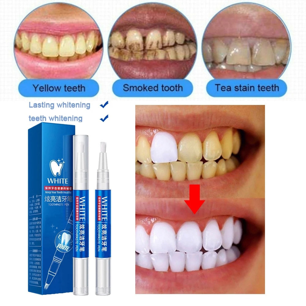 Teeth Whitening Pen Tooth Gel Whitener Bleach Remove Stains Oral Hygiene Cleaning Gel Fresh Breath Whiten Teeth Cleaning Serum